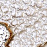 dorado_textura