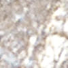 champaña_textura
