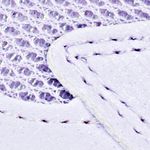lila_textura