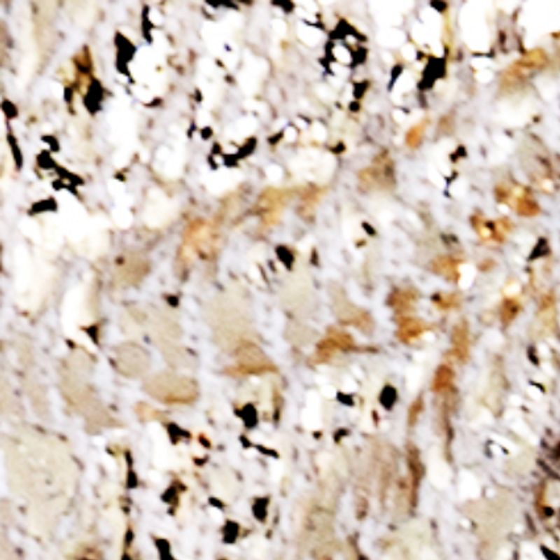 beige_textura